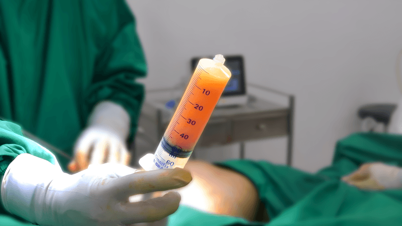 Detailed illustration of the LAMS procedure highlighting its minimally invasive nature
