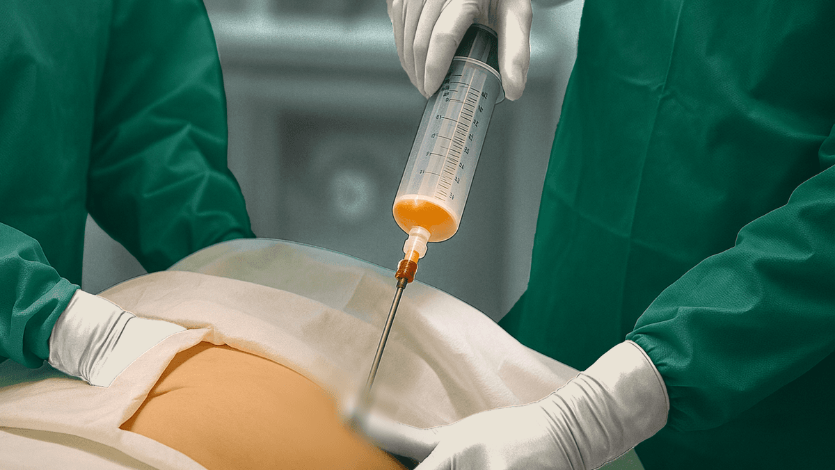 treatment-image
